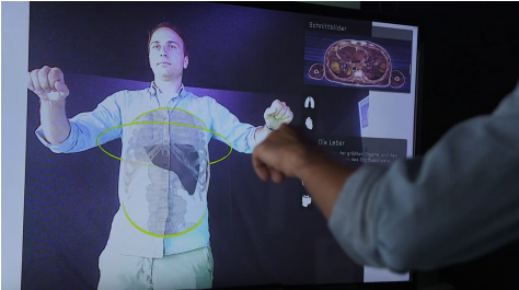 Kinect for Interactive AR Anatomy Learning